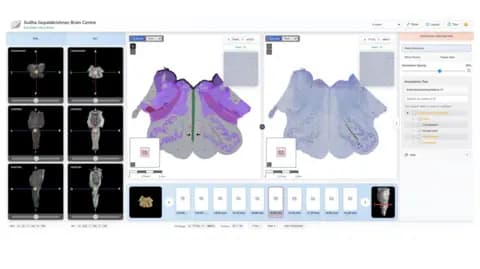 SGBC ANCHOR online viewer enabling a seamless transition from gross brain structures in the MRI to features at the cellular level