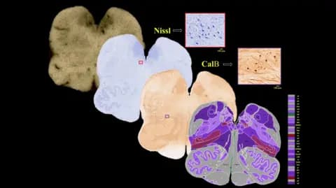 SGBC Brainstem sections on a map